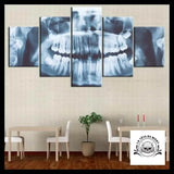 Tableau Crâne Rayon X
