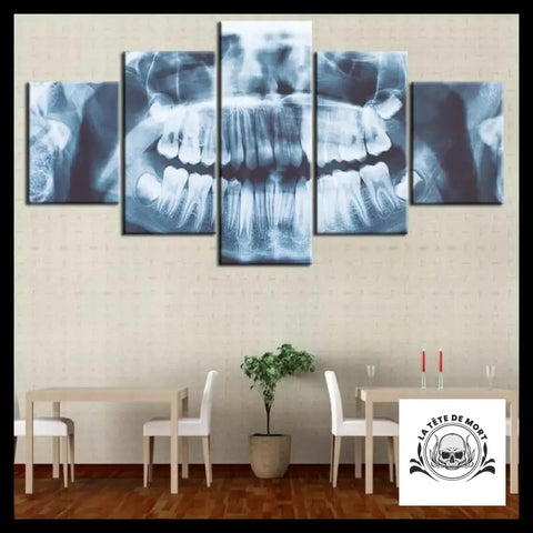 Tableau Crâne Rayon X